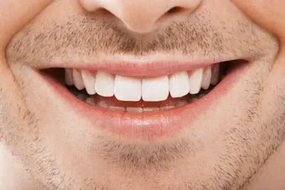 closeup of a man's smile after periodontal treatment