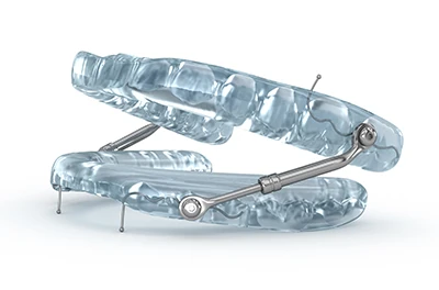 sleep apnea oral appliances in Lawrenceville, GA