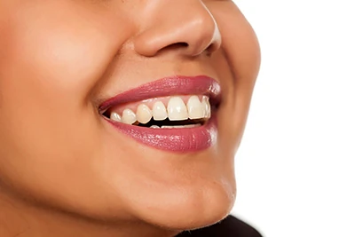 closeup of a freshly cleaned smile